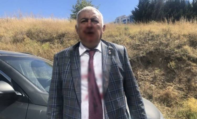 Ümit Özdağ'ın azmettirdiği kişilerce darp edildiğini iddia eden Zafer Partisi Kurucular Kurulu Üyesi Soner Çam partiden istifa etti